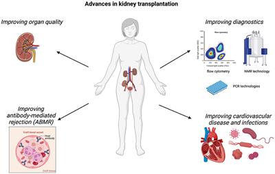 Editorial: Advances in the diagnosis and treatment in kidney transplantation